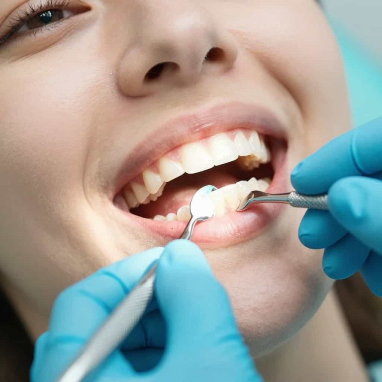 Dentista realizando limpieza dental preventiva en Mazatlán.